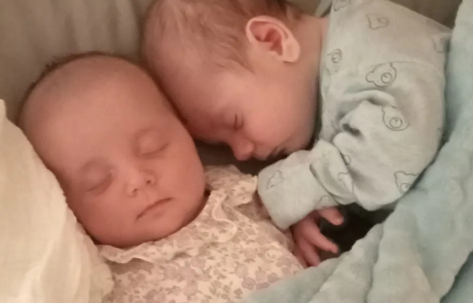gemelos raros nacen a la vez